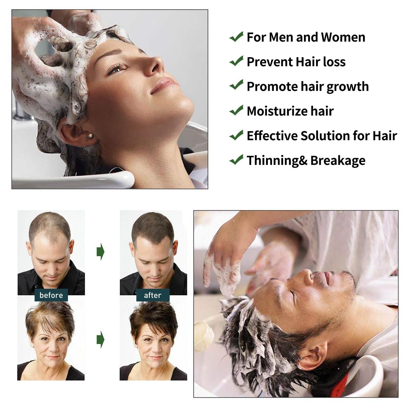 Prevent Hair Loss and Moisturize Hair, Deep Cleansing Scalp Shampoo for Thicker, Shinier Hair ,100ml