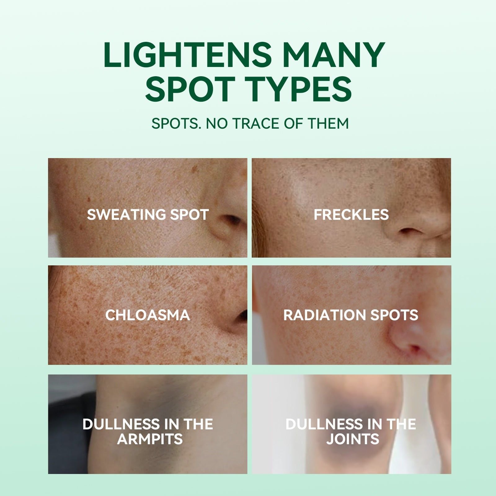Dark Spot Corrector Serum, Brighten Skin, Fade Age & Sun Spots, Hydrating, Fast Results ,30ml