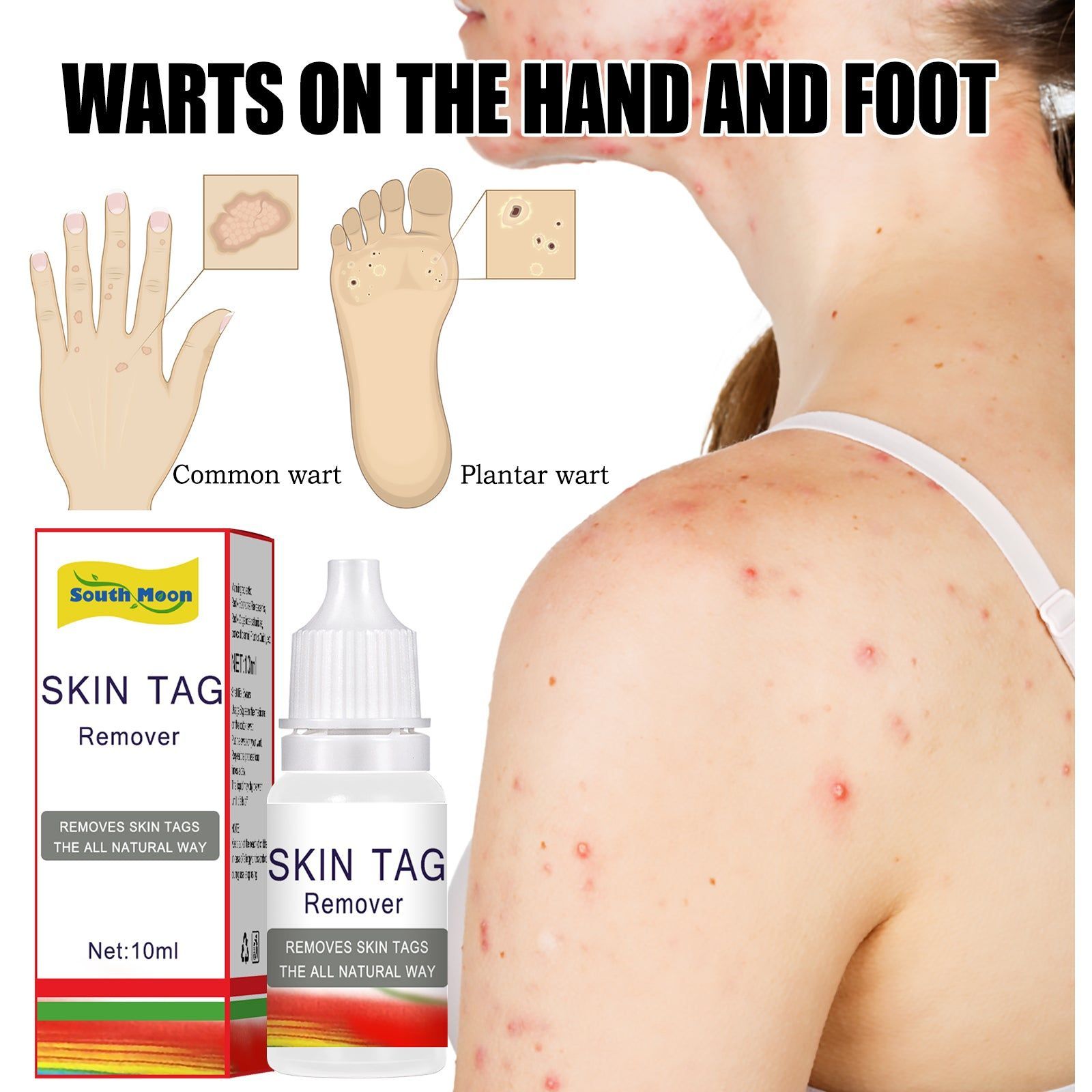 Antiwart Liquid for Fast Wart Removal, Gentle Skin Care, Clear Heat Detox ,10ml