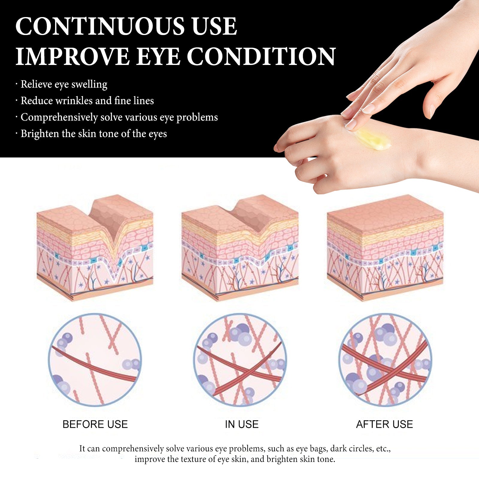Revitalize Your Eyes with Gentle Hydrating Eye Care Cream for Dark Circles and Aging ,30g