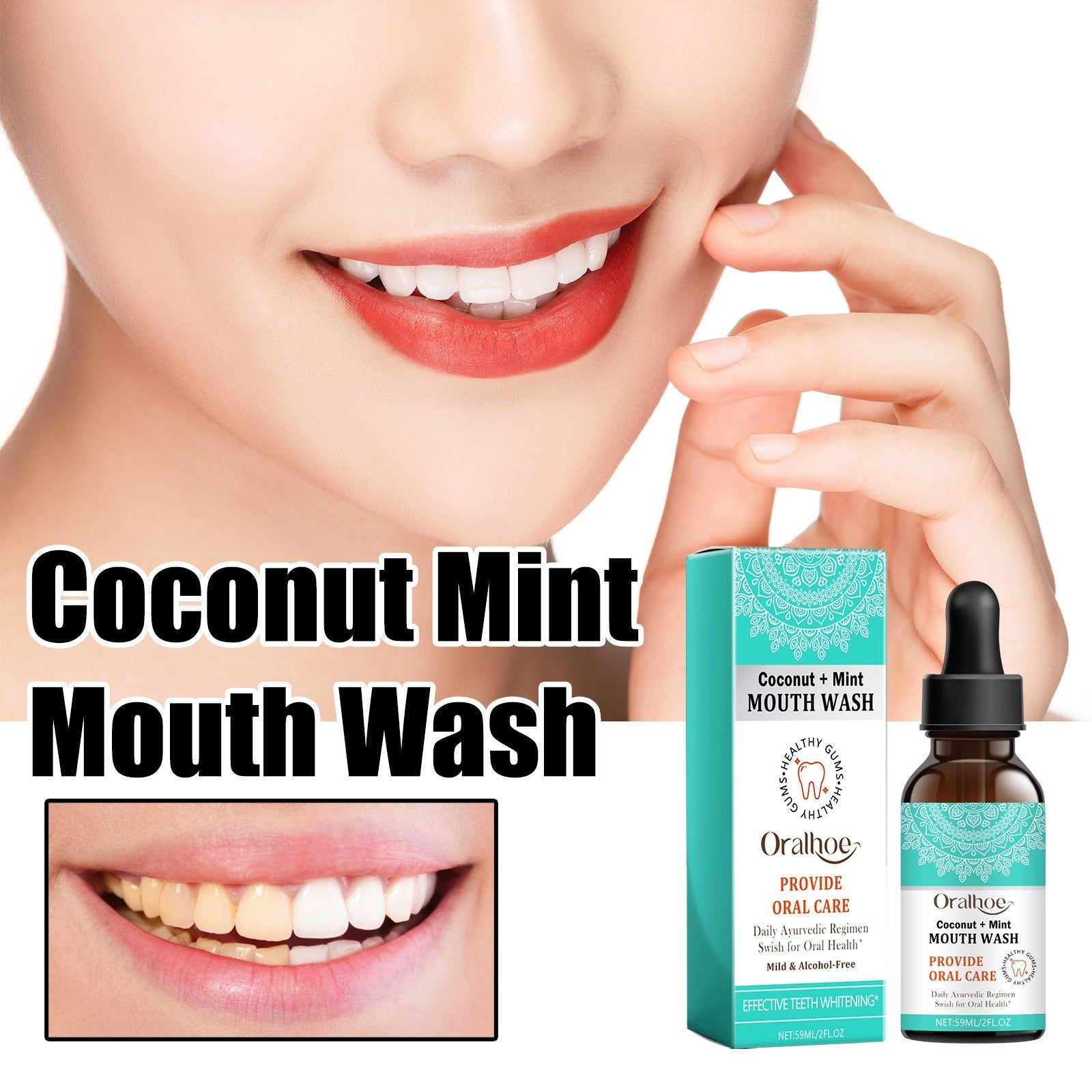 Coconut Mint Mouth Wash, Fresh Breath, Teeth Whitening, Plaque & Tartar Removal ,59ml