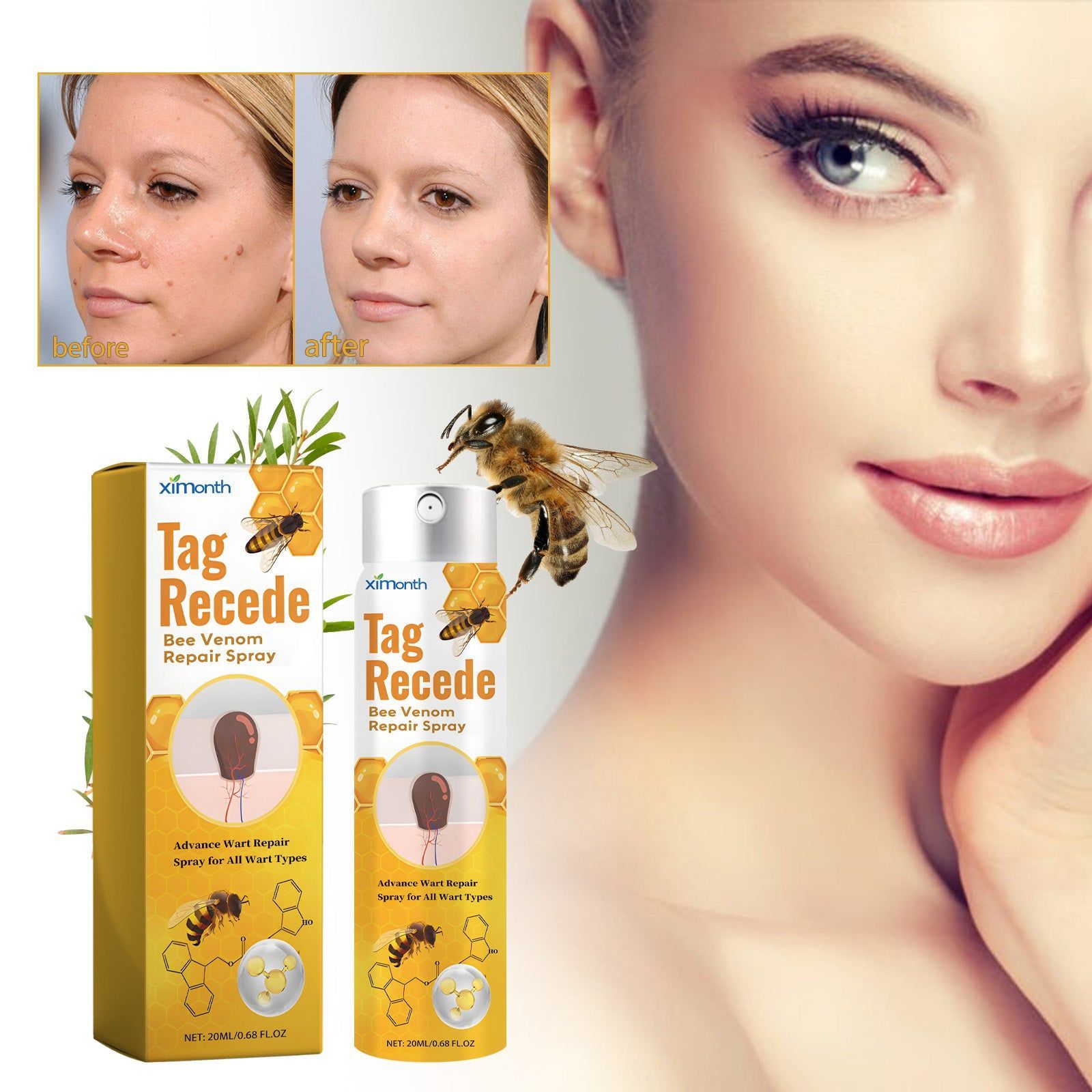 Beesvenom Wart Care Spray for Smooth Skin, Skin Repair, Wart Removal, Natural Skin Lightening ,20ml