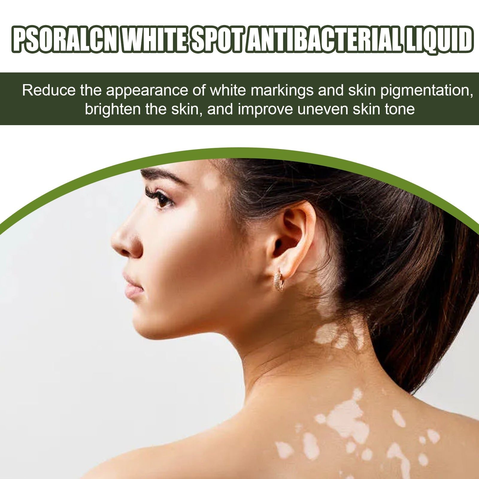 Brighten Skin and Reduce White Spots, Repair Pigmentation, Moisturizing Serum ,30ml