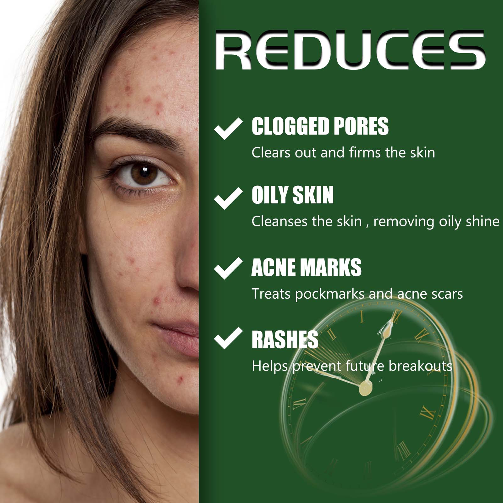 Clear Acne Scar Repair Cream, Salicylic Acid, Vitamin E, Pimple Treatment, Suitable for Facial Skin ,30g