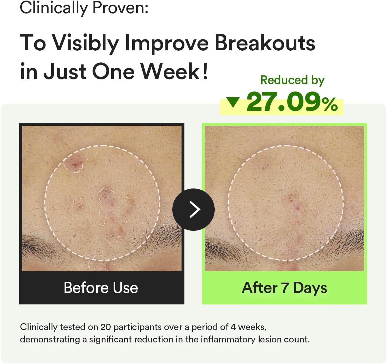 ABIB HEARTLEAF TECA CAPSULE SERUM CALMING DROP