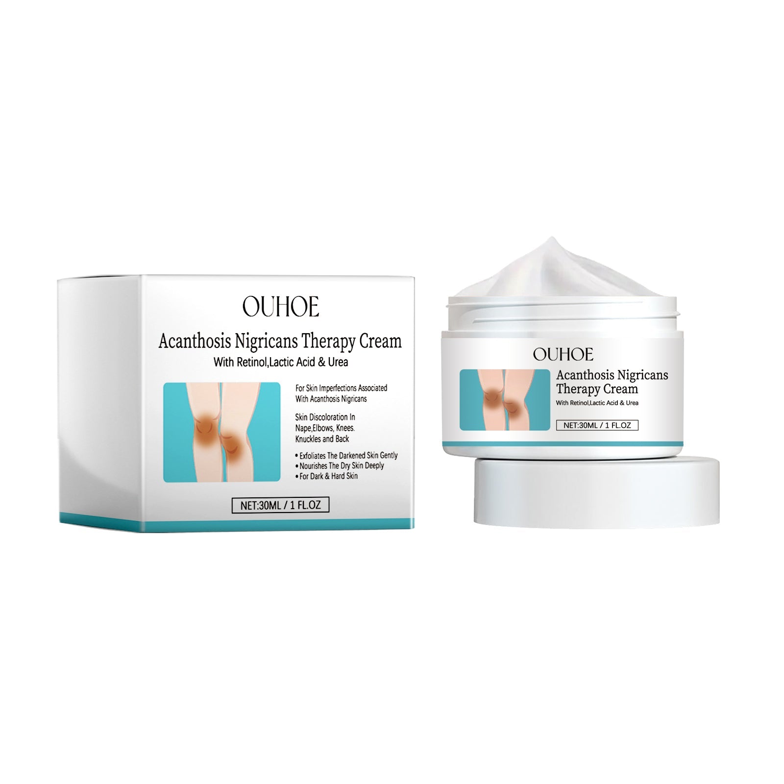 Acanthosis Nigricans Cream, Fade Joint Black Spots, Brighten Skin, Moisturize, Repair ,30ml