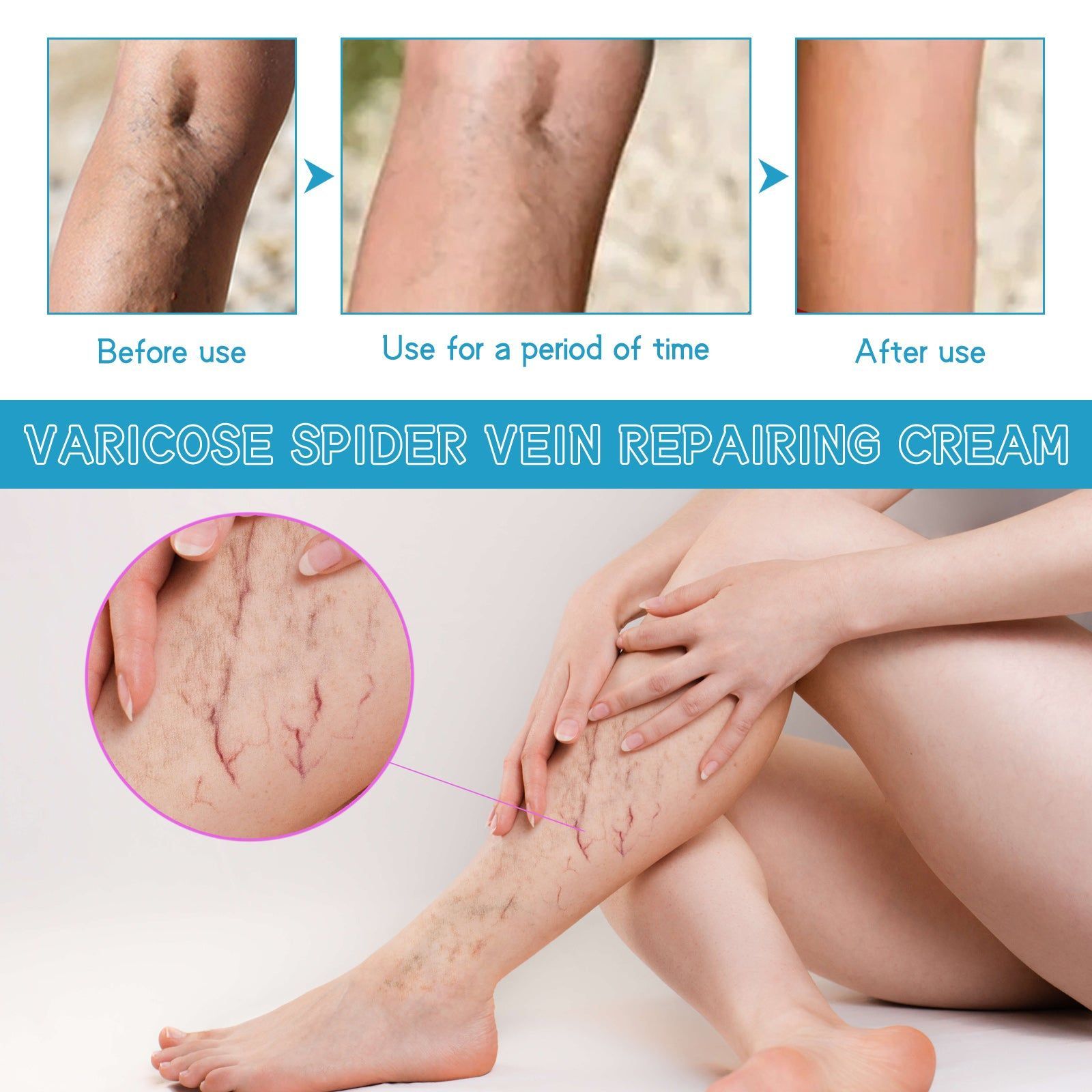 Revitalize Your Legs with Top-Rated Vein Repair Cream, Fast-Acting Intravenous Relief ,30g