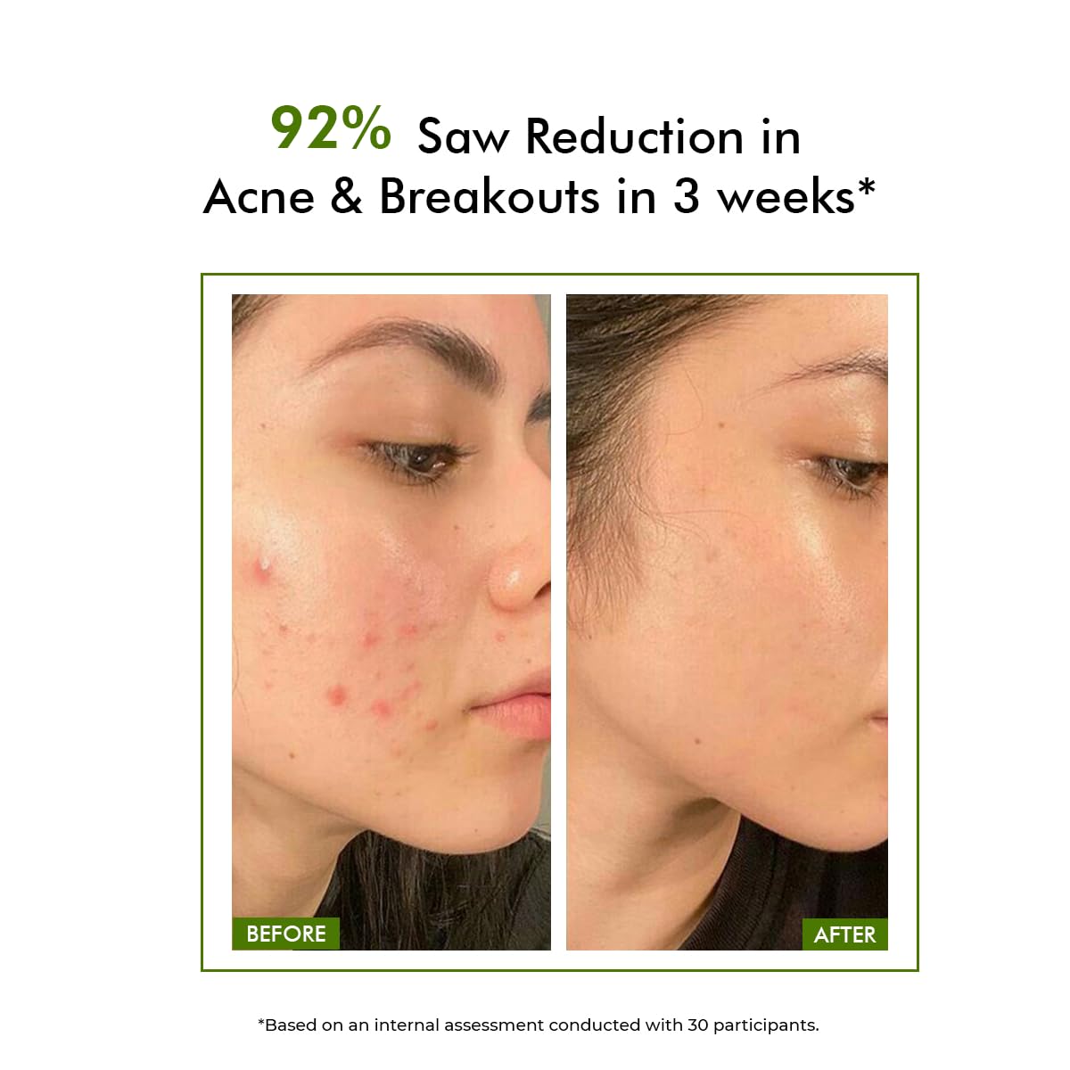 Conscious Chemist 2% Salicylic Acid Face Wash | 100ml