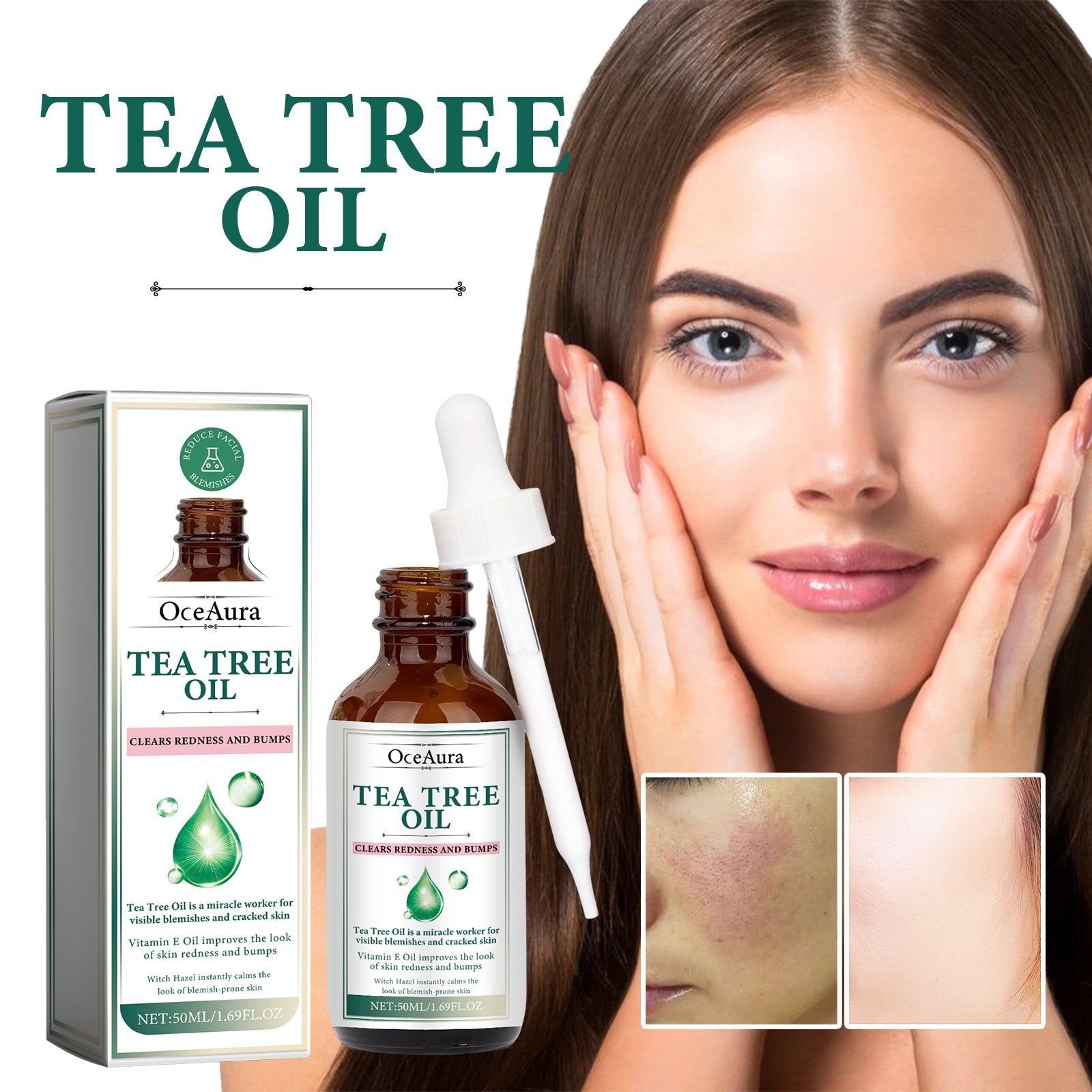 Tea Tree Oil for Moisturize and Tender Skin, Clear Pimples, Reduce Dark Spots ,50ml