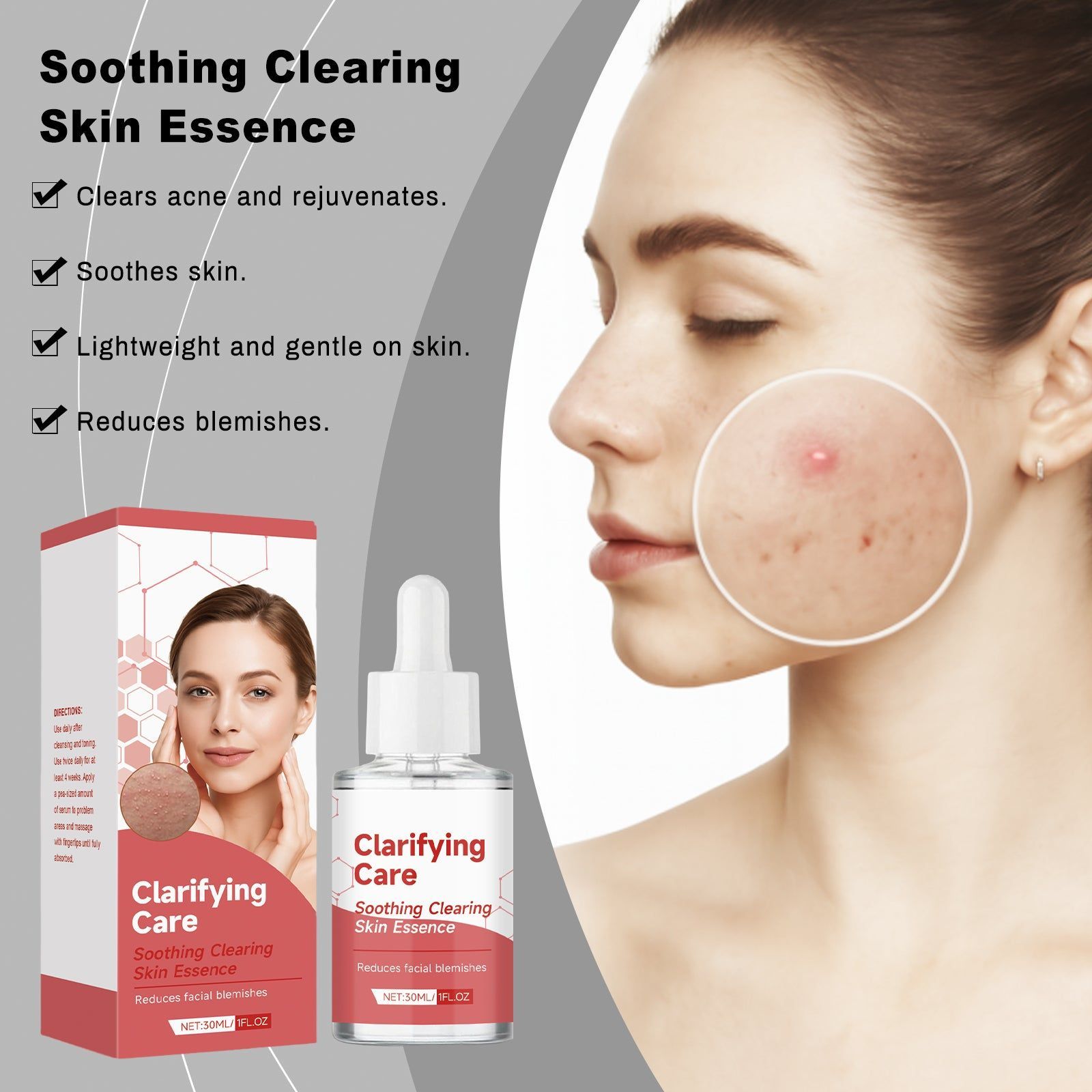 Acne Care Essence, Clear Skin, Hydrating, Tea Tree Oil, Blemish Treatment, Fast Results ,30ml