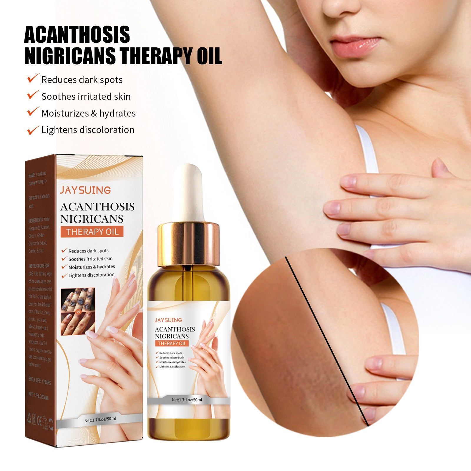 Brighten and Exfoliate Dark Skin, Acanthosis Nigricans Therapy Oil, Moisturizing Repair ,50ml