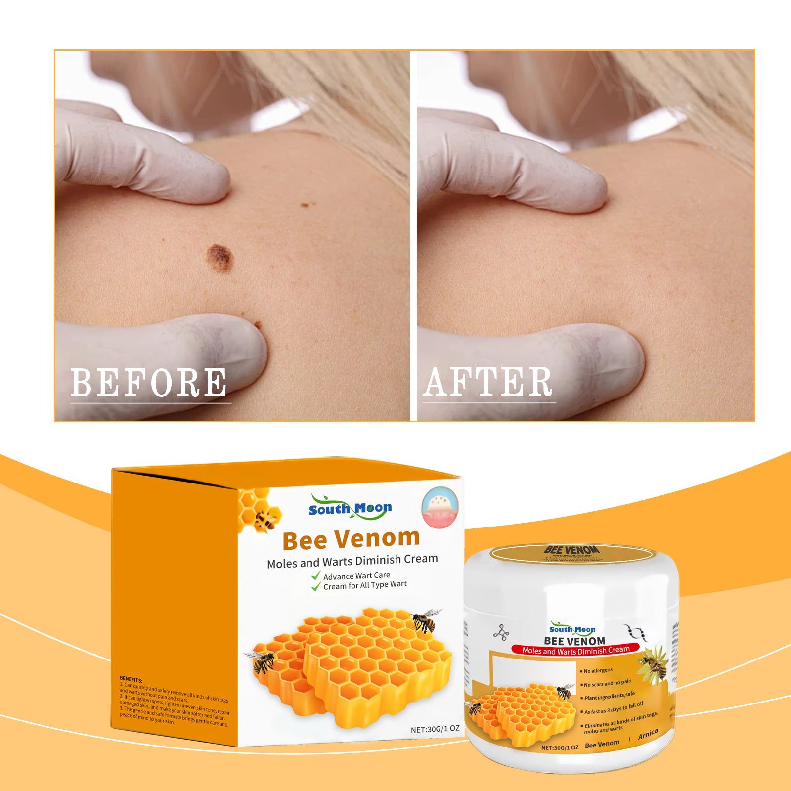 Bee Venom Body Care Cream, Skin Repair, Smooth, Tender, Wart & Label Removal ,30g