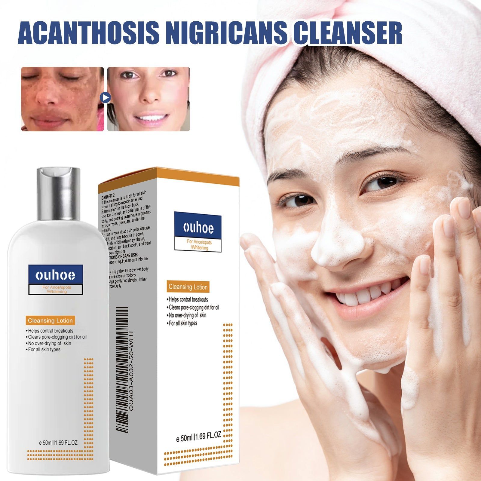 Black Acanthoderm Face Cleanser, Brighten Dark Spots, Oil Control, Moisturizing ,50ml