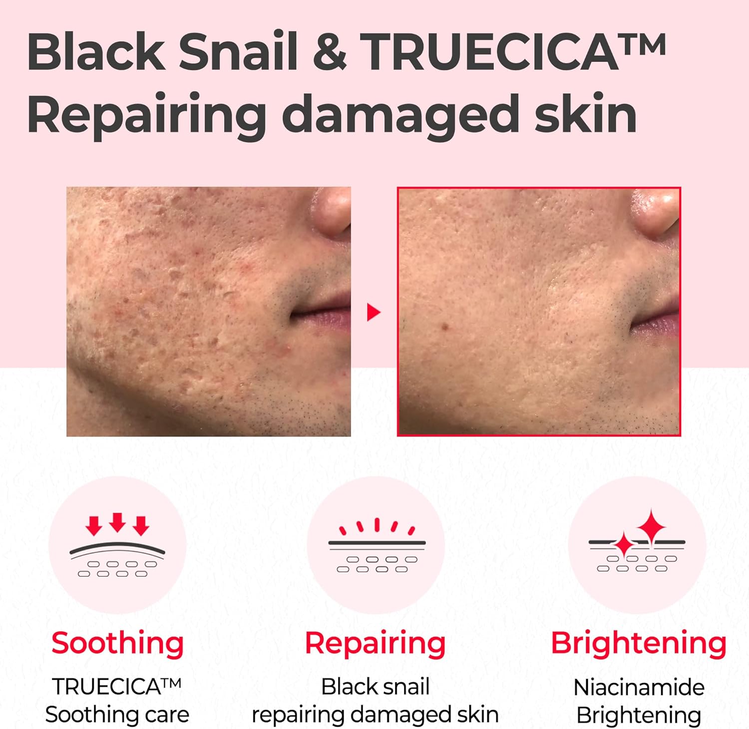 تونر Some By Mi Snail Truecica Miracle Repair 135 مل