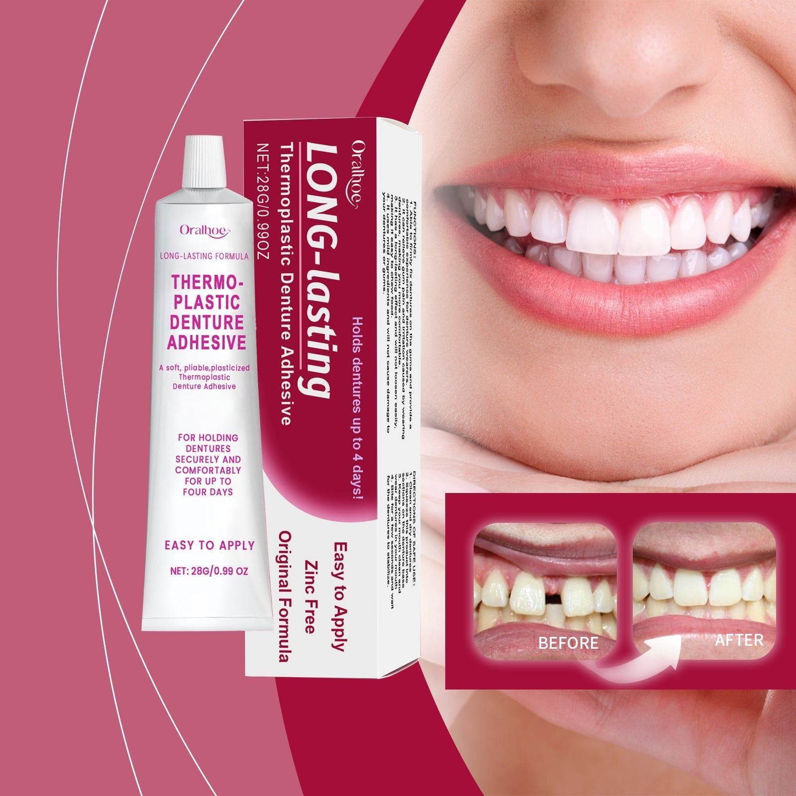 Denture Fixation Adhesive, Long-Lasting, Comfortable, Gum Care, Thermoplastic ,28g