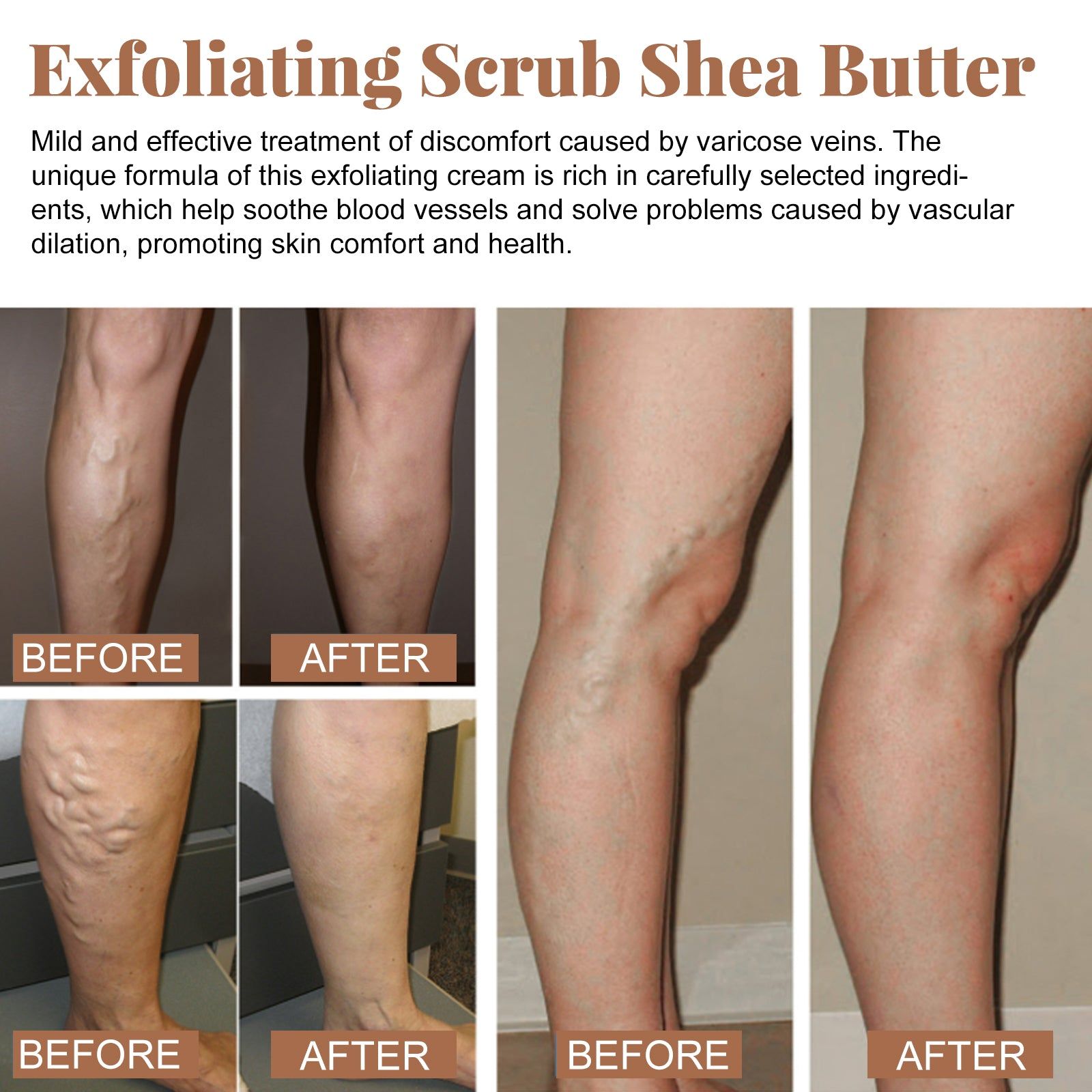 Revitalize Your Skin with Venous Body Scrub, Natural Body Cleansing for Varicose Veins ,100ml