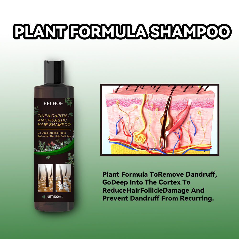 Anti-Dandruff Itch Relief Shampoo for Scalp, Deep Nourishing Hair Care, Natural Ingredients ,100ml