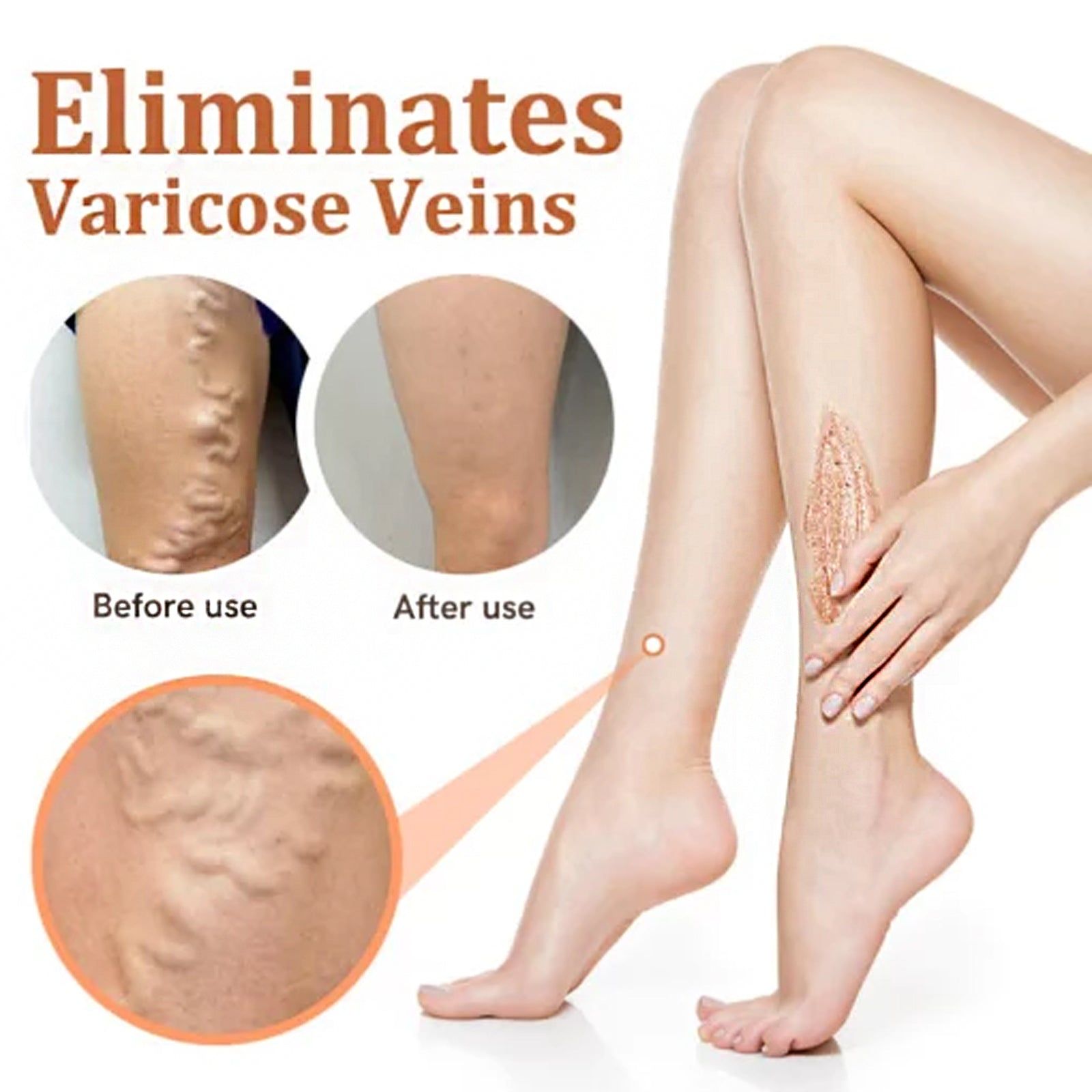 Revitalize Your Skin with Venous Body Scrub, Natural Body Cleansing for Varicose Veins ,100ml