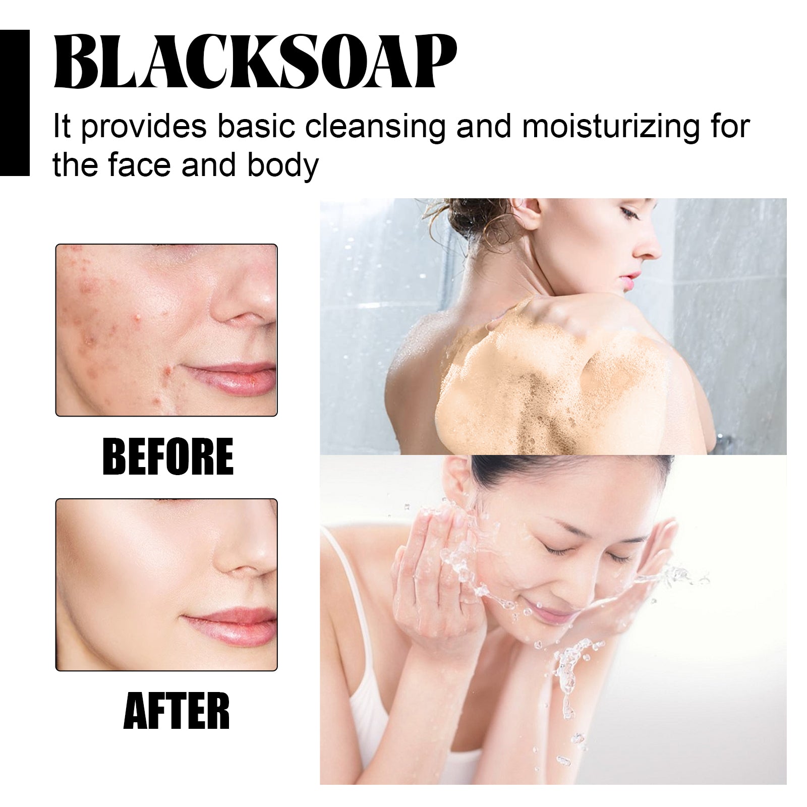 Black Soap for Acne, Pores, Moisturizing, Clear Skin, Body Black Soap, Natural Skincare ,100g