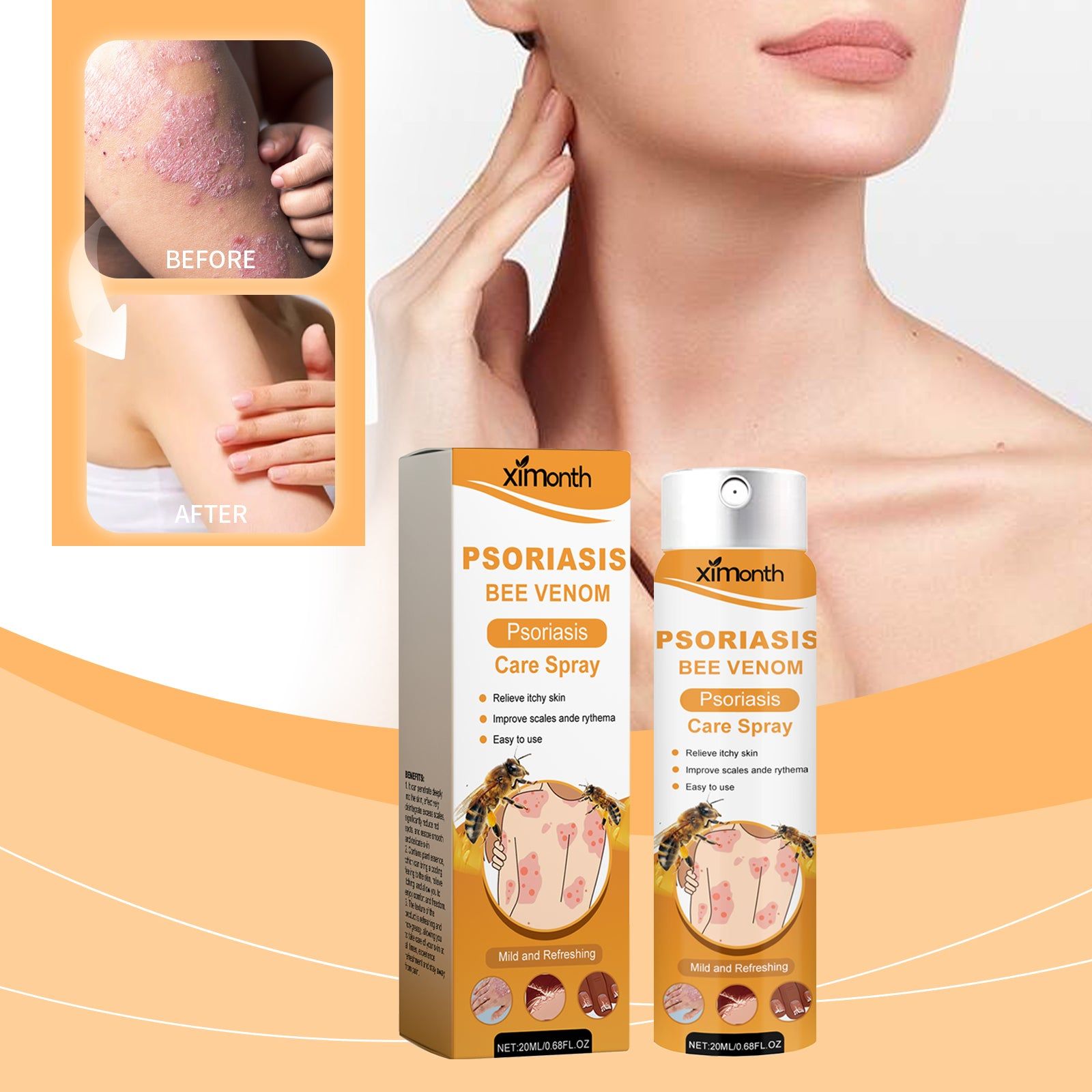 Bee Venom Psoriasis Care Spray, Anti-Itch, Skin Relief, Natural Healing, Fast Results ,20ml