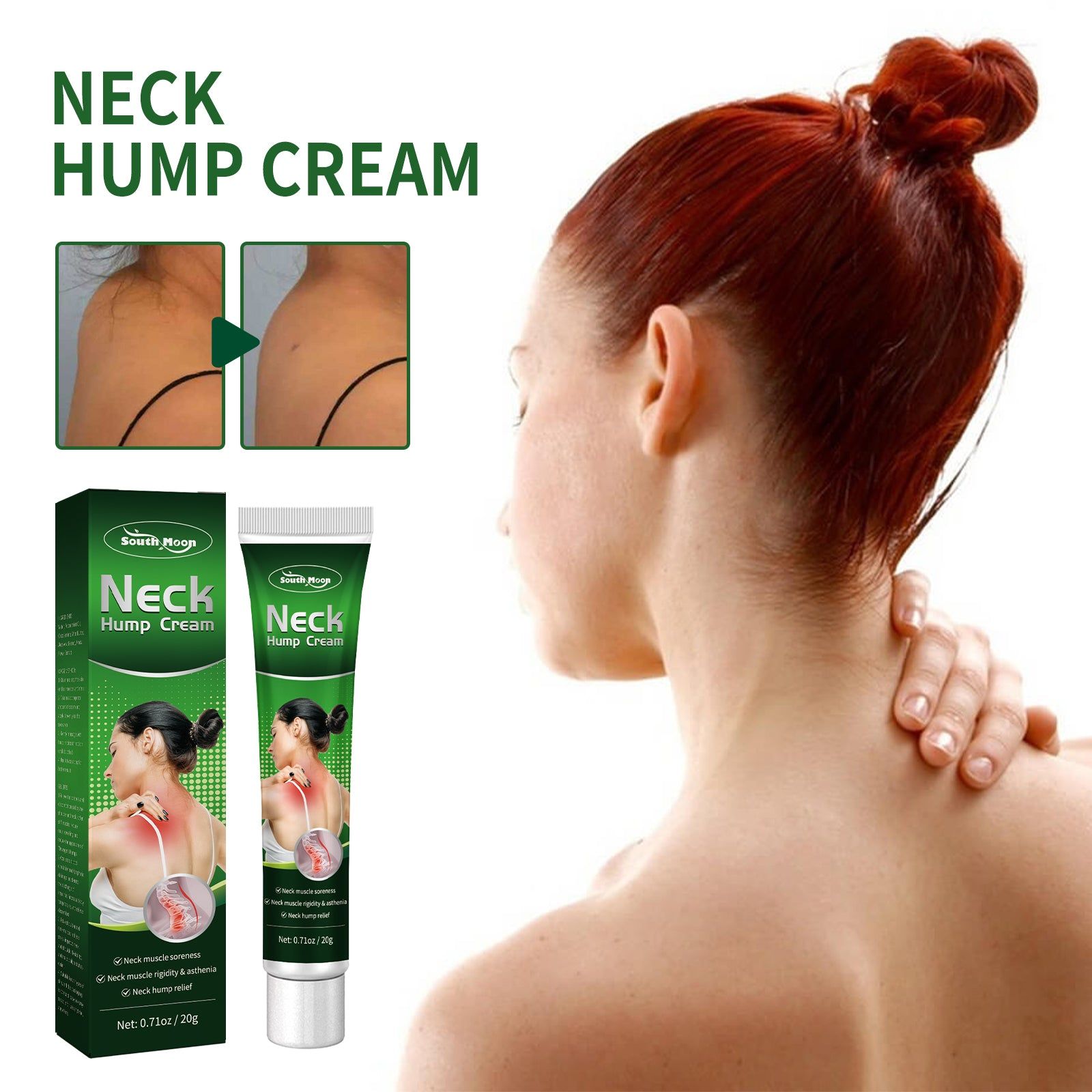 Relieve Cervical Spine Pain, Sedentary Muscle Soreness, Neck Hump Cream, Natural Joint Care ,20g
