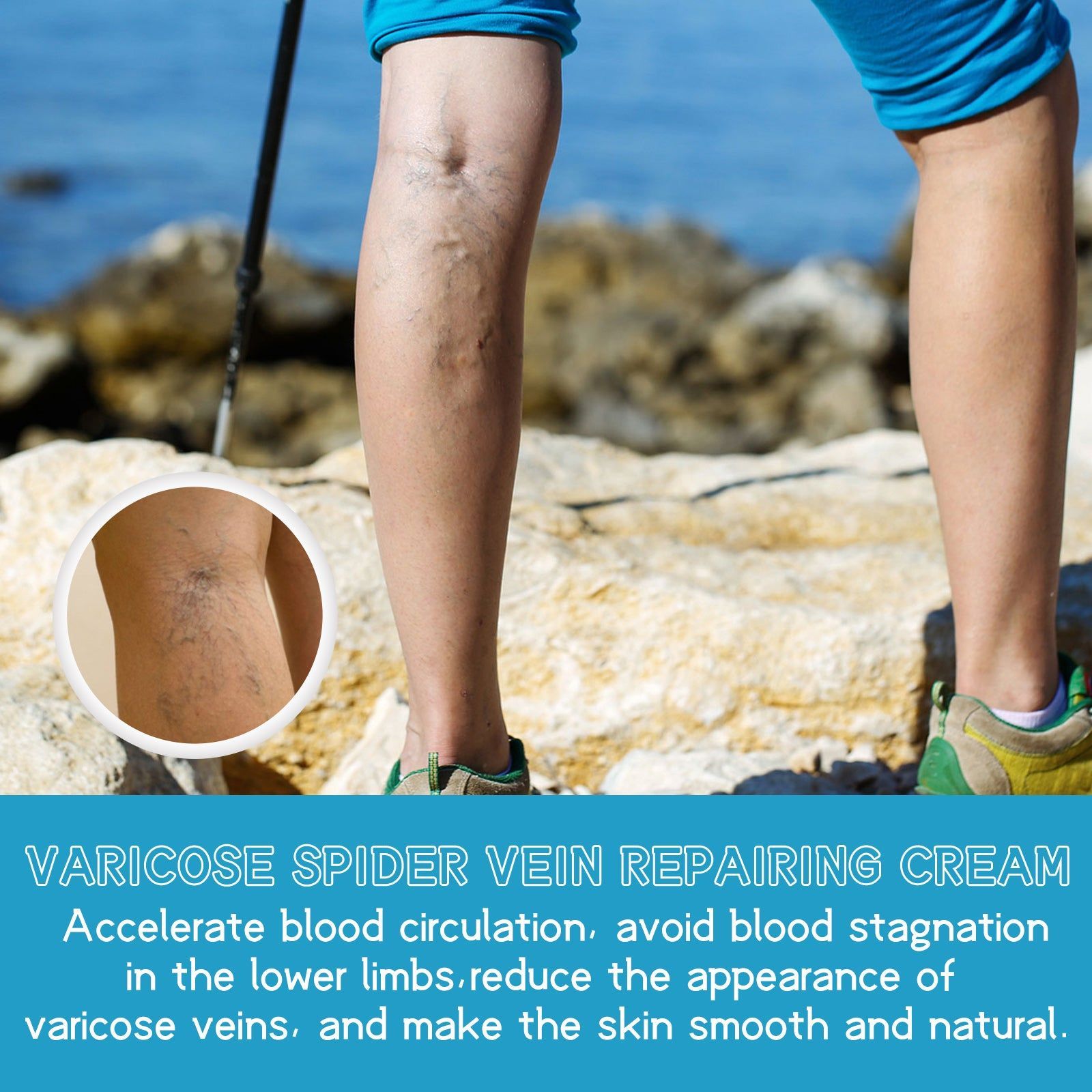Revitalize Your Legs with Top-Rated Vein Repair Cream, Fast-Acting Intravenous Relief ,30g