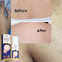 Back Care Spray Fade Acne Marks Soft Skin Moisturizer for Clear Back ,60ml