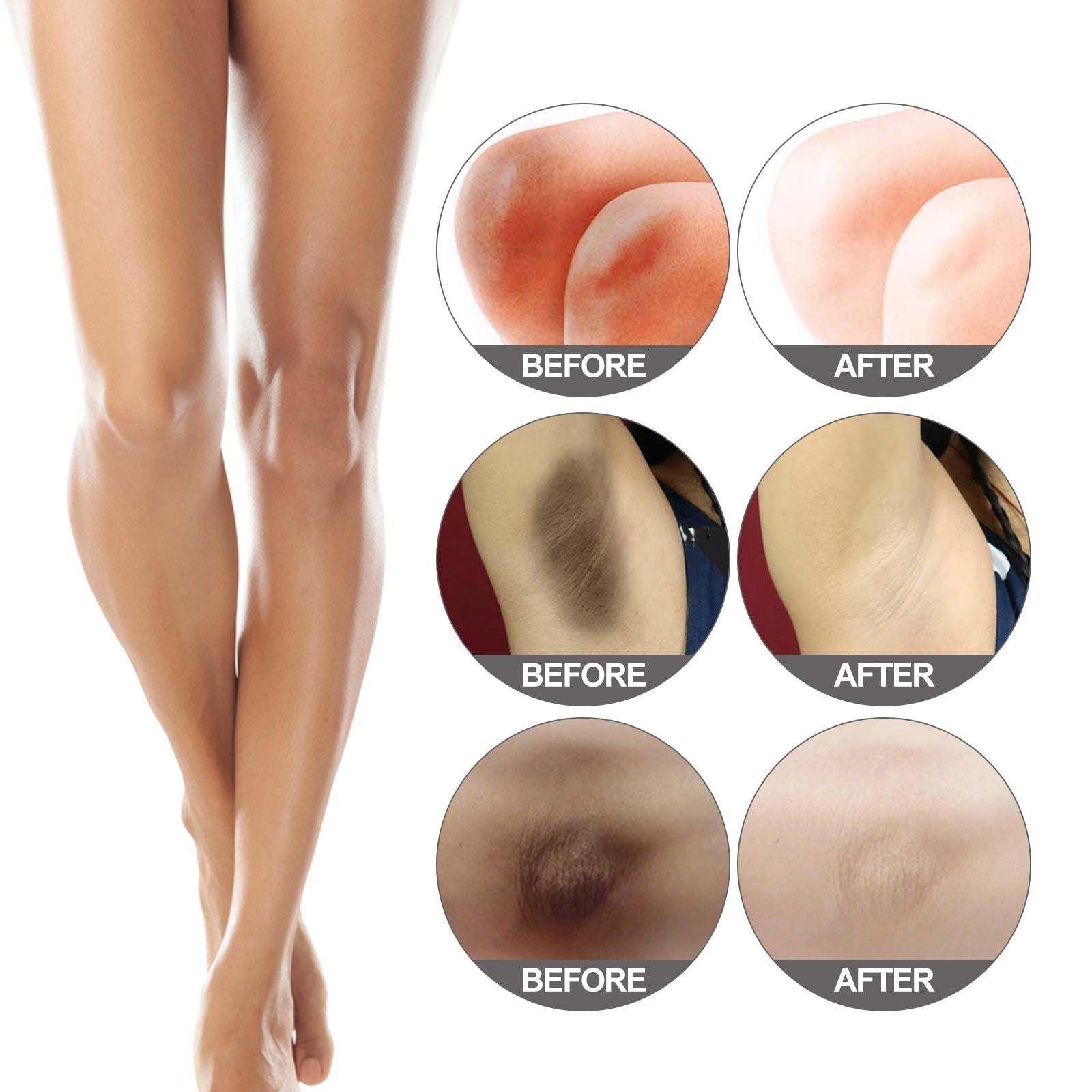 Brightening Skin Moisturizing Spray for Dull Armpits, Dark Joints, Smooth Skin ,30ml