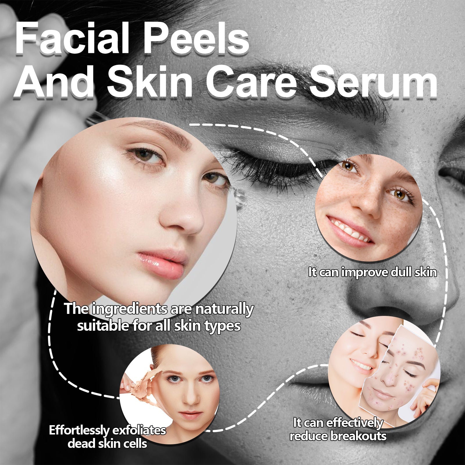 Brighten Skin Serum for Acne Marks, Clear Pores, Natural Face Treatment ,30ml