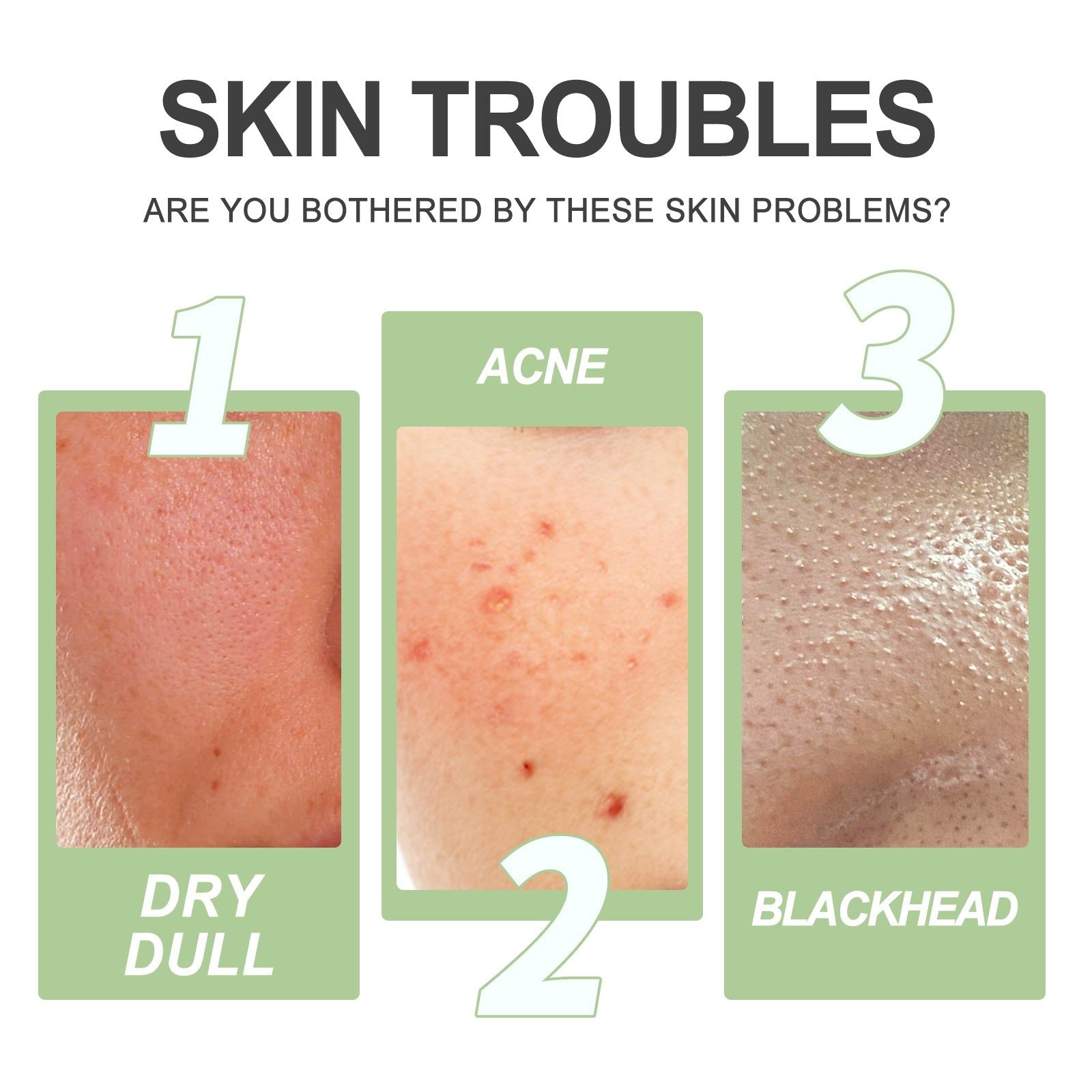 Brightening Cleansing Exfoliating Gel for Smoother, Clear, Radiant Skin ,30ml