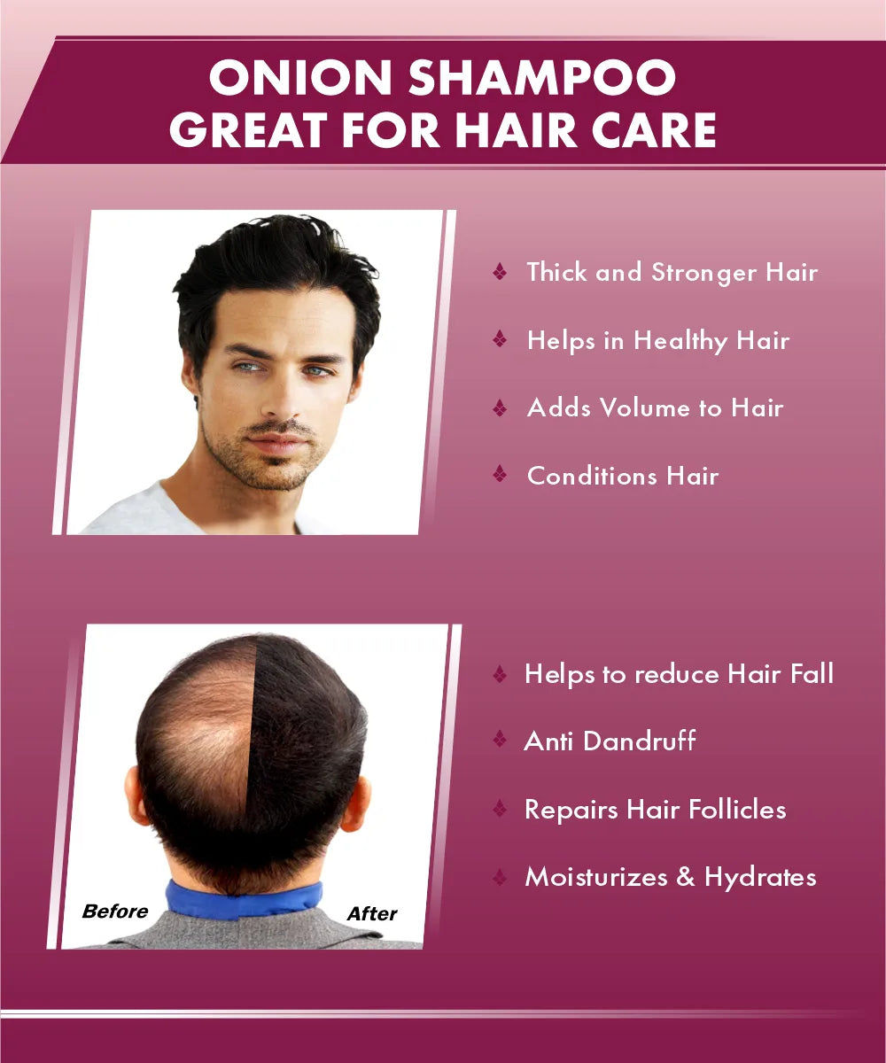 Urban Gabru Natural Onion shampoo for hair strengthening & hairfall control 200 gm