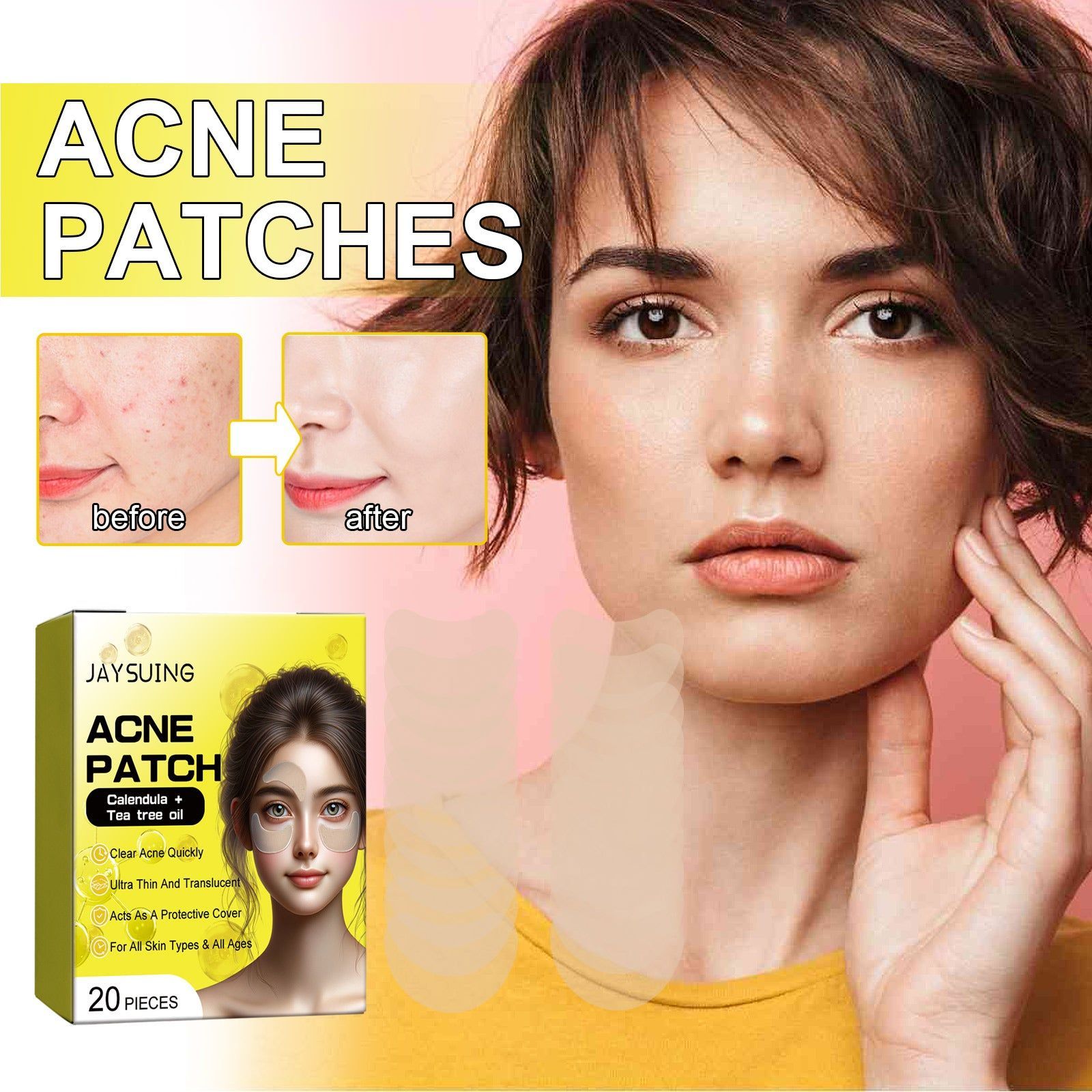 Clear Acne Fast with Tea Tree Hydrocolloid Patches for Facial Cleansing, Pore Detox, and Skin Repair ,20pcs