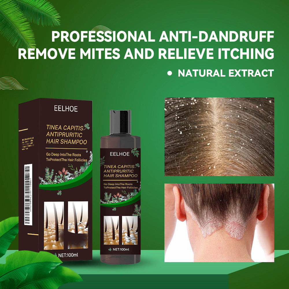 Anti-Dandruff Itch Relief Shampoo for Scalp, Deep Nourishing Hair Care, Natural Ingredients ,100ml