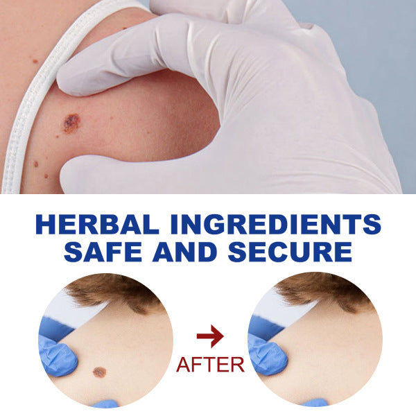 Liquid Pen for Rapid Healing, Skin Care, Face & Body, Gentle & Safe ,1pcs