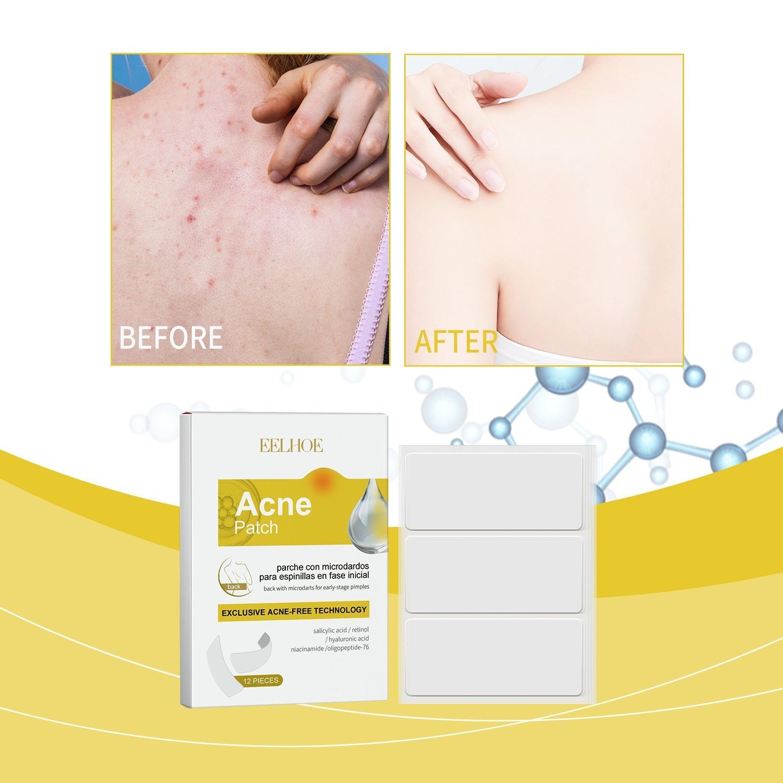 Back Acne Patch for Skin Repair, Clear, Gentle, Breathable, Fast Inflammation Relief ,12pieces