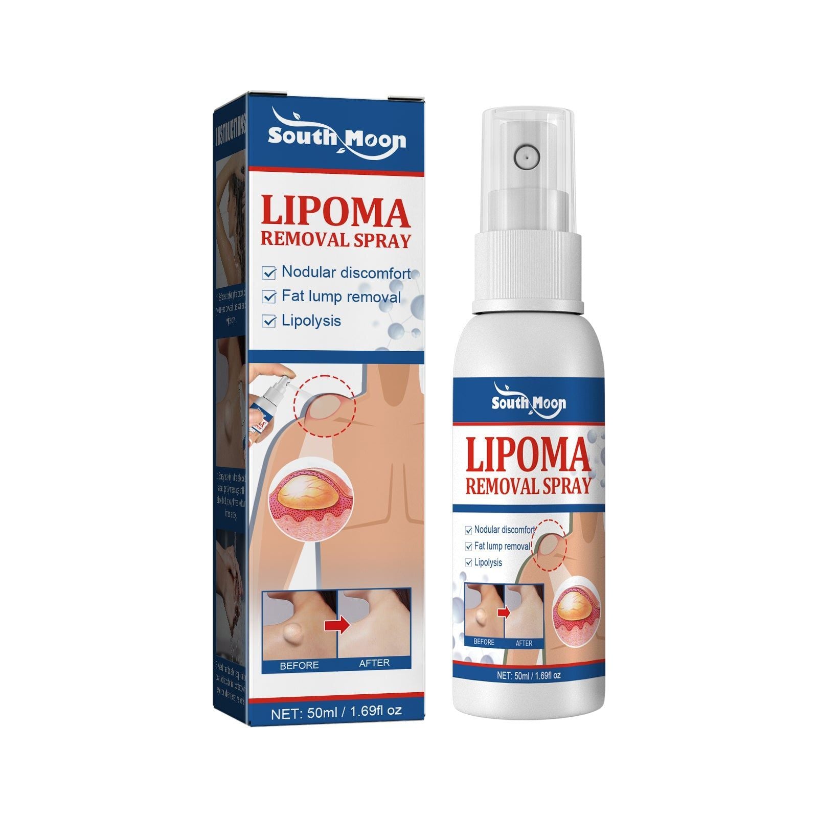 Body Care Spray, Skin Relief, Repair, Tightness & Discomfort, Lipoma Solution ,50ml