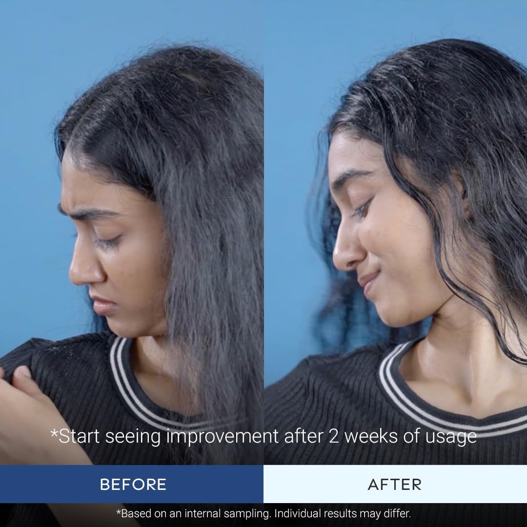 Arata Anti Dandruff Shampoo For Normal To Oily Hair (200 Ml)