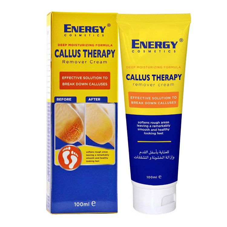 Energy Cosmetics Callus Remover Cream Sj, 100ml