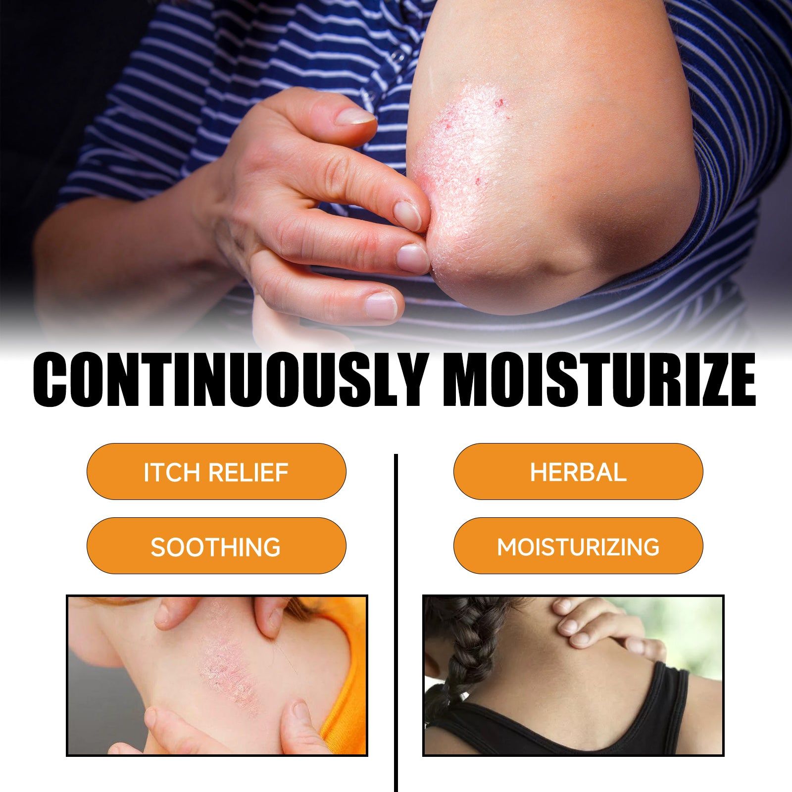 Bee Venom Psoriasis Cream, Skin Repair, Soothing Moisturizer for Redness and Discomfort ,30g