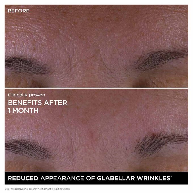 طاقة لشد البشرة بشكل فائق