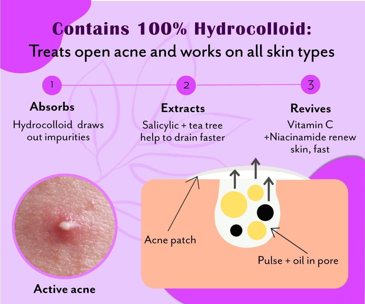 Urban Yog Acne Curvy Pimple Patch - Invisible Facial Stickers cover with 100% Hydrocolloid, Pimple/Acne Absorbing patch