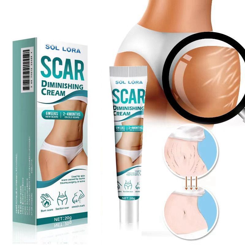 SOL LORA Scar Diminishing Cream - Herbal Formula for Surgical Scars, C-Section Scars, Acne Marks & Postpartum Stretch Marks