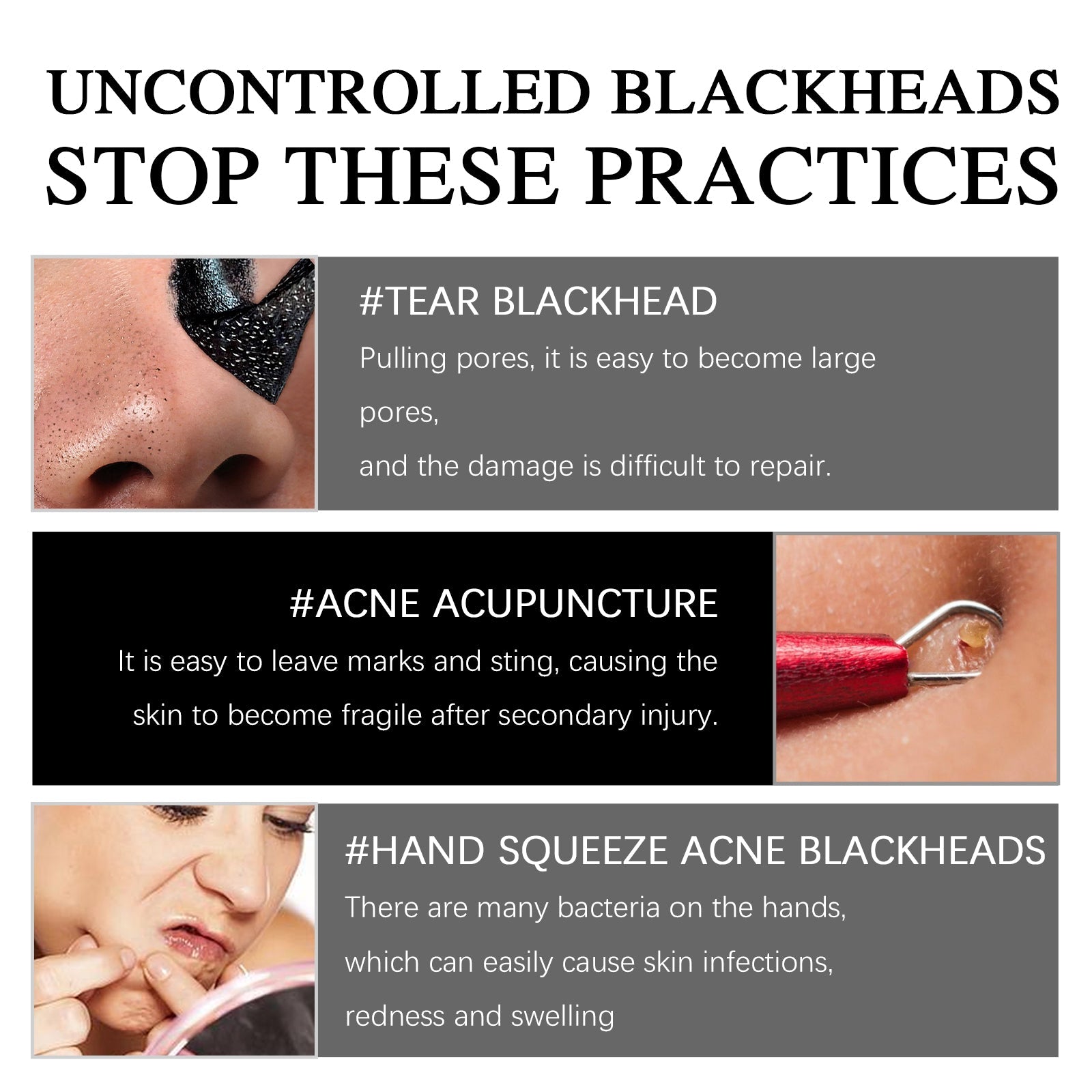 Blackhead Removal Mask, Deep Pore Cleanser, Clear Skin, Oil Control, Pimple Treatment ,50g