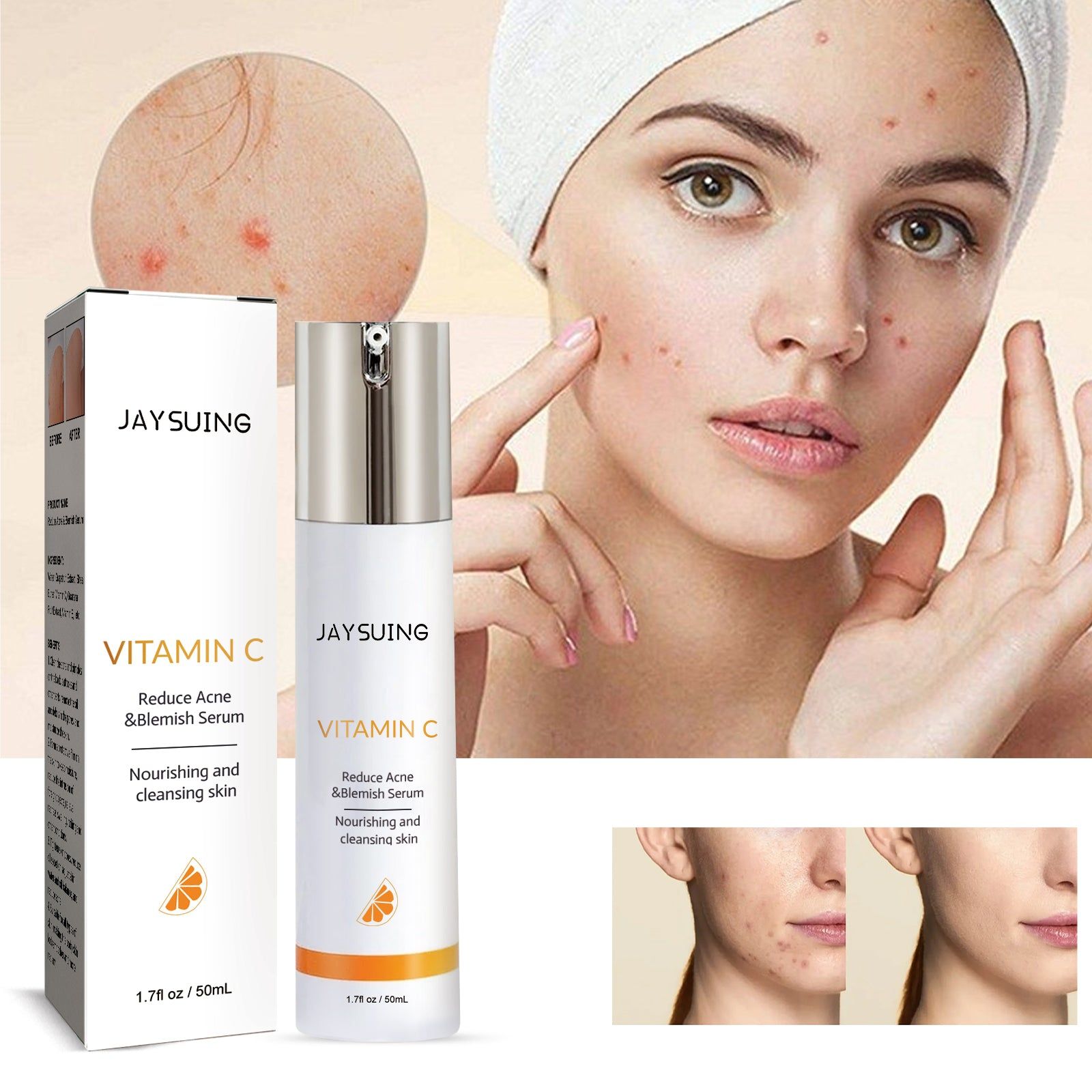 Clear Skin Serum for Acne, Pore Tightening, Oil Control, Brightening, Fast Results ,50ml