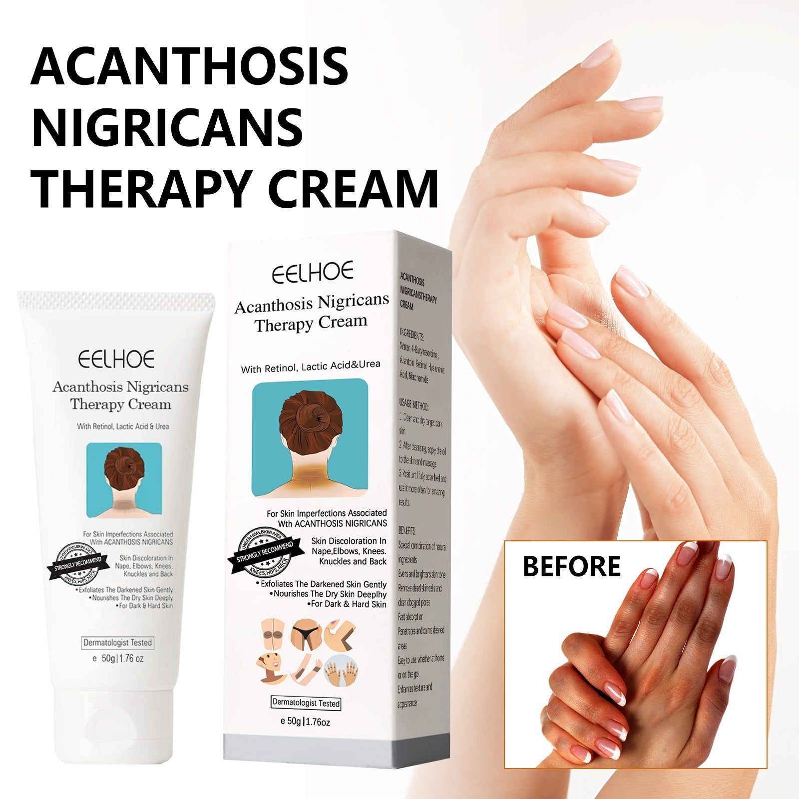 Black Acanthoderm Repair Cream for Brightening, Whitening, Moisturizing, and Skin Repair ,50g