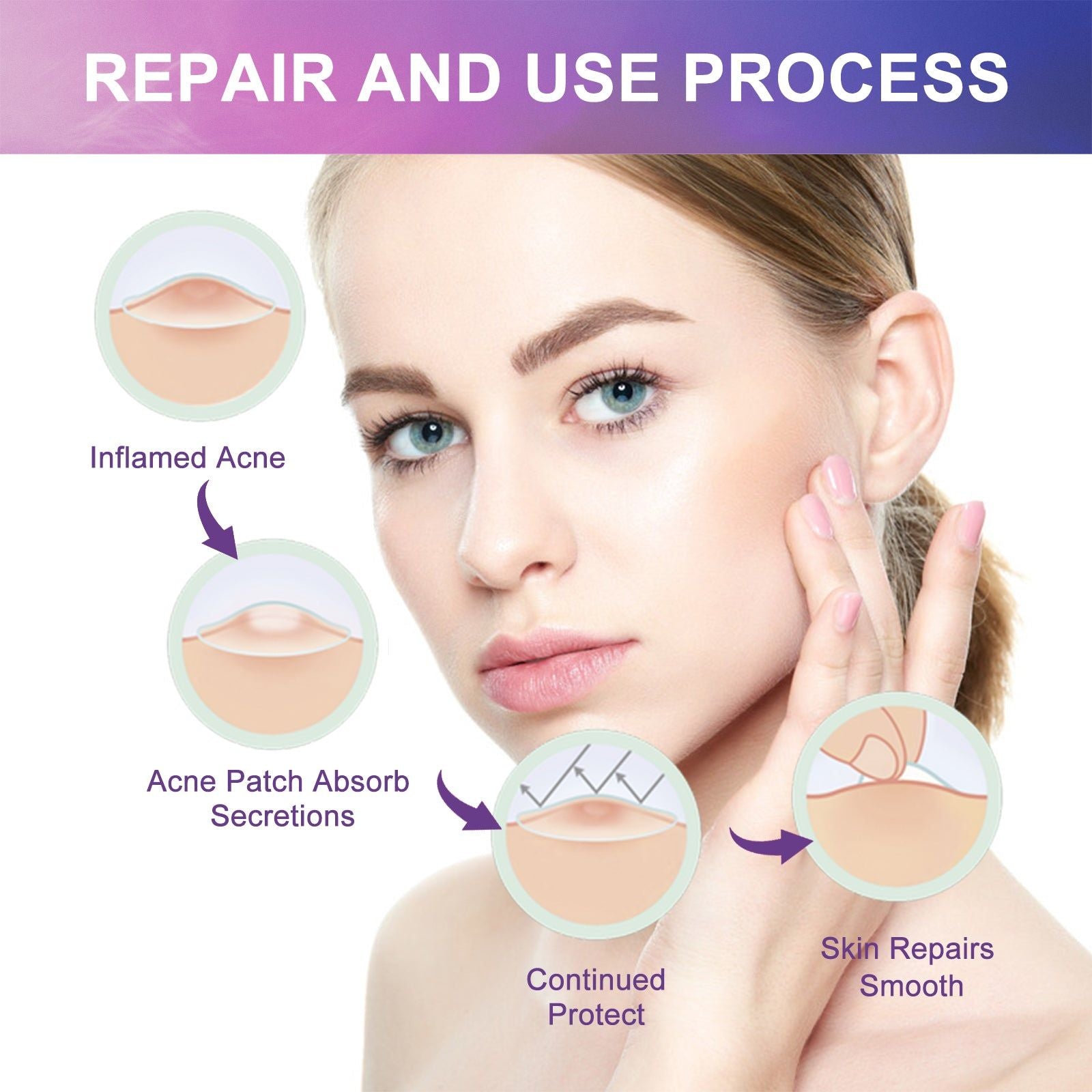 Color Acne Patch Cover Reduce Pimples Spots Hydrocolloid Clear Skin ,144pcs