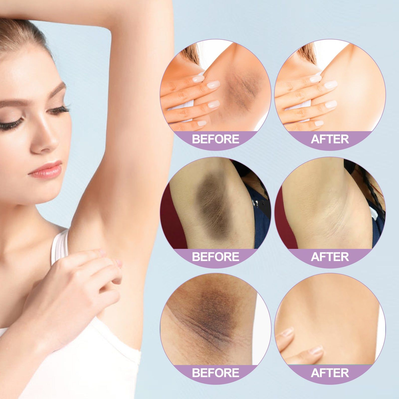 Brightening Underarm Serum, Fade Dullness, Moisturize, Soft Skin, Glutathione, Niacinamide ,10ml/box