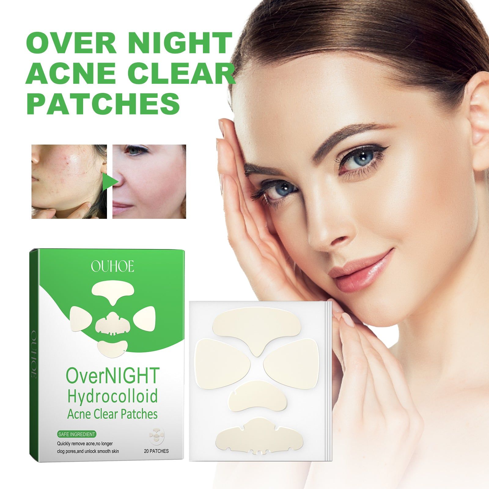 Overnight Acne Repair Patches, Clear Pimples Fast, Reduce Scars, Gentle Skin Care ,20patches