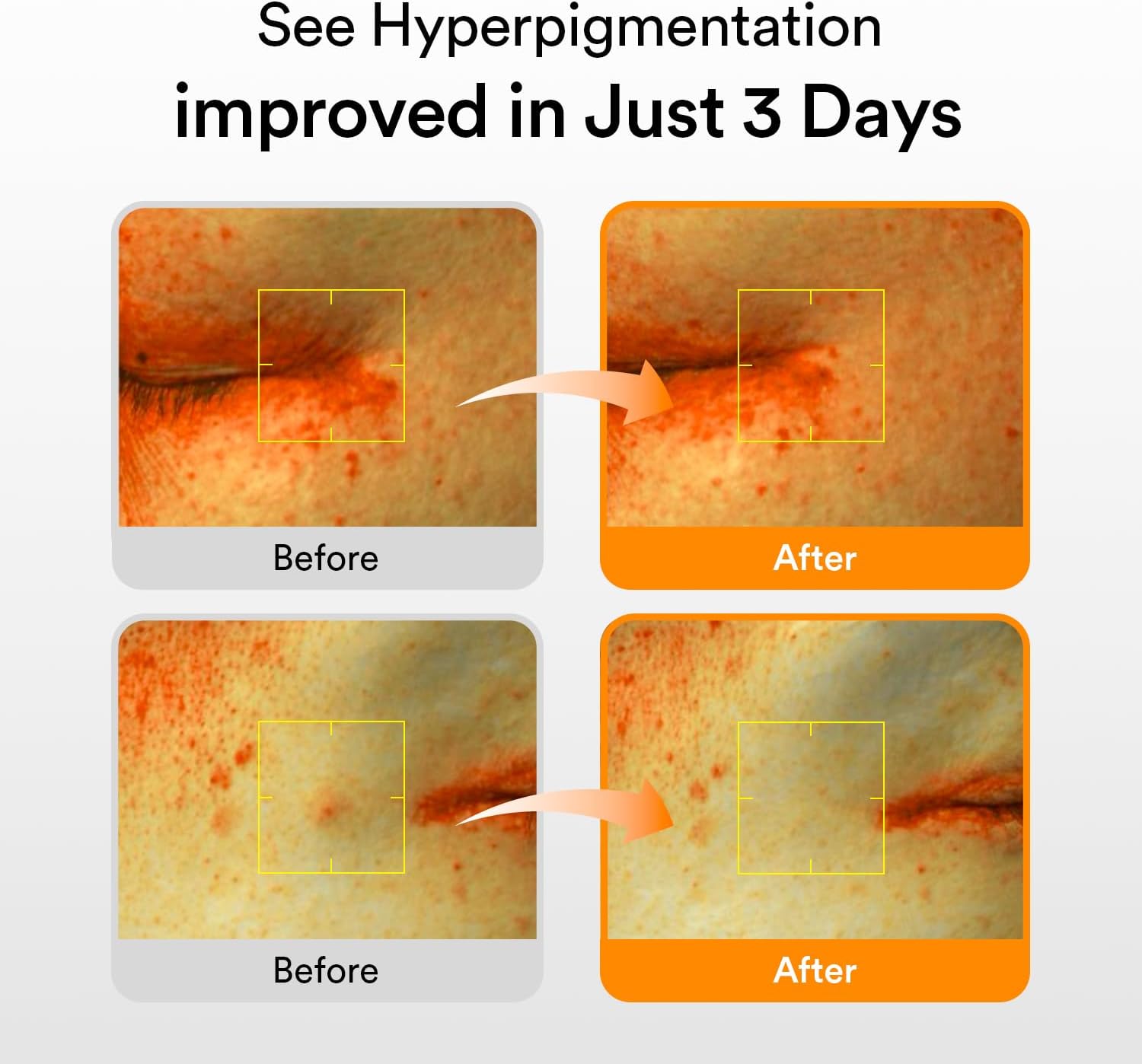 Abib Glutathiosome Dark Spot Serum Vita drop 1.69 fl.oz. | Korean Skincare, Dark Spot, Hyperpigmentation Treatment | Brightening Serum for Sensitive, Uneven Skin | Niacinamide, Viatmin C