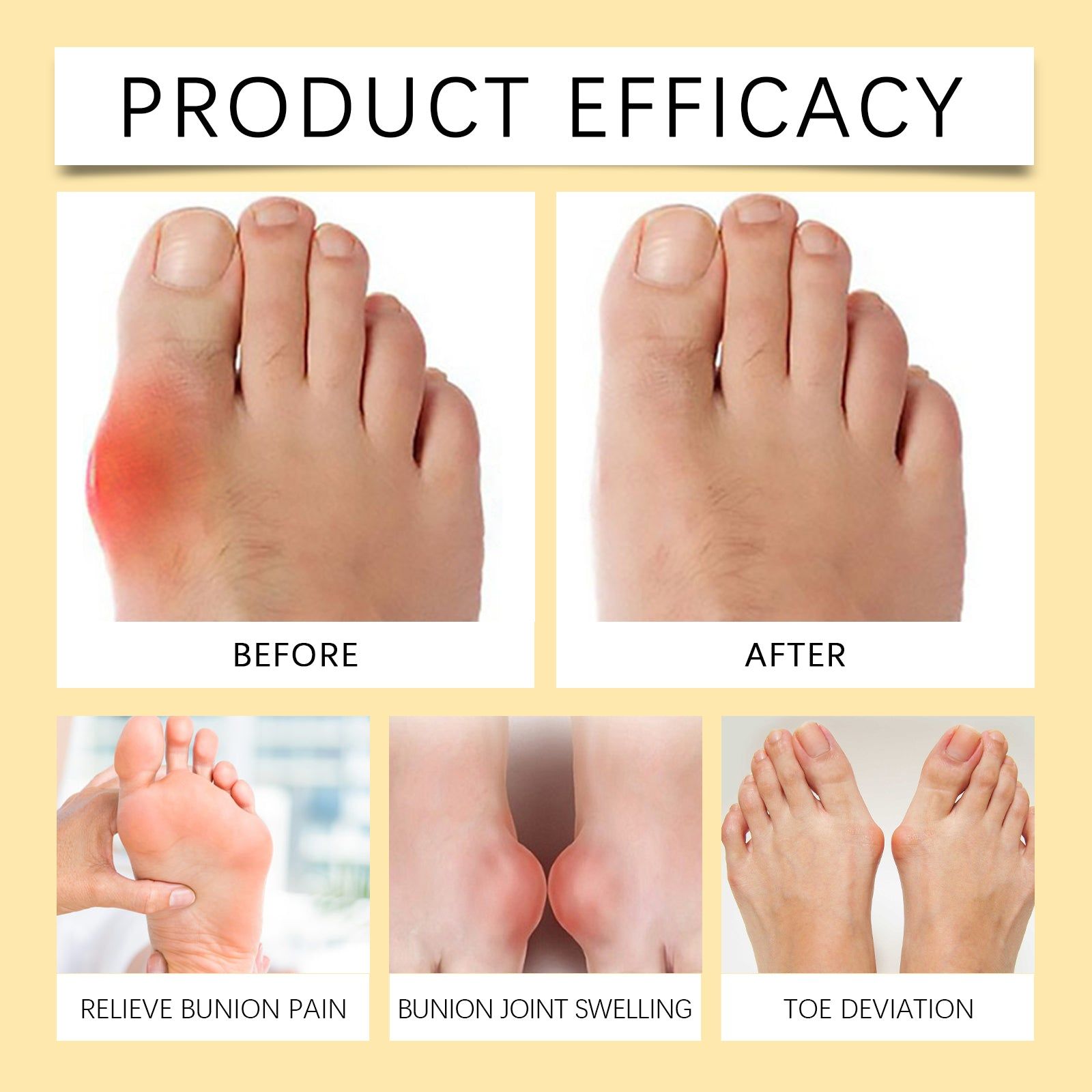 Bee Venom Cream for Bunion Pain, Joint Inflammation, Natural Relief ,20g